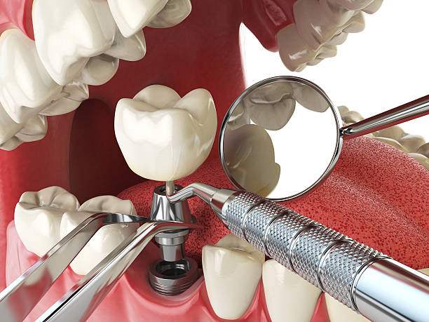 Dentist for Dental Trauma in KS